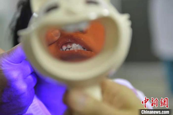 看牙动辄上千，口腔机构却连年亏损，钱让谁赚了？